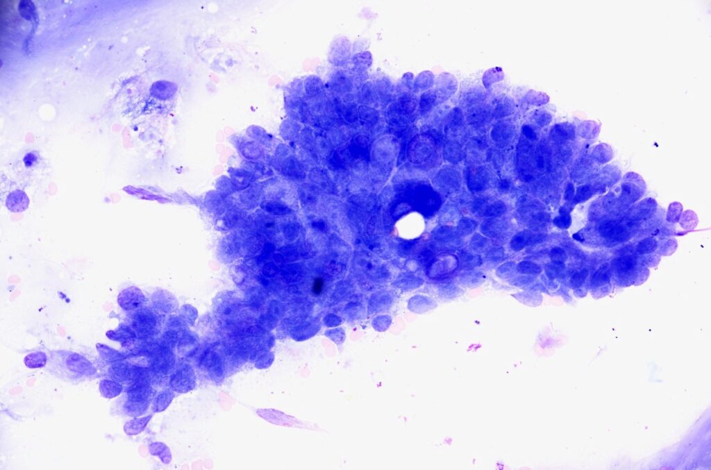 ultrasound guided cytology from JSAP journal of small animal practice 